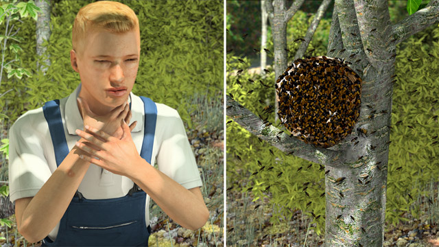 First Aid - Flying Insect Stings