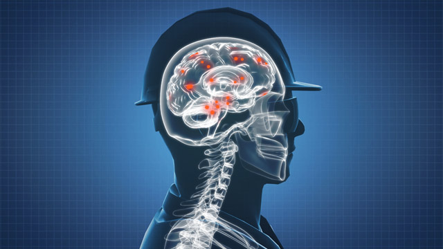 First Aid - Seizures